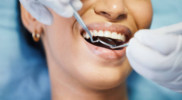 Best Emergency Dental Care for Broken or Chipped Teeth in Glasgow Village, MO