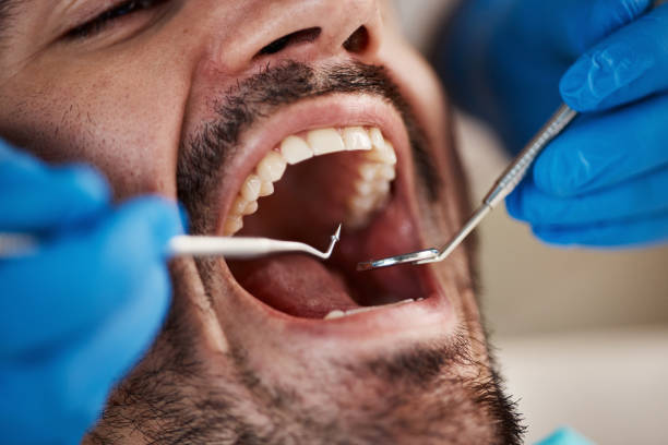 Best Urgent Care for Lost Fillings or Crowns in Glasgow Village, MO