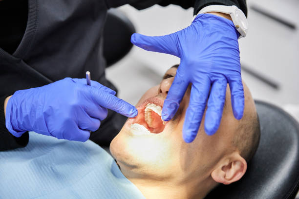 Best After-Hours Dental Trauma Care in Glasgow Village, MO