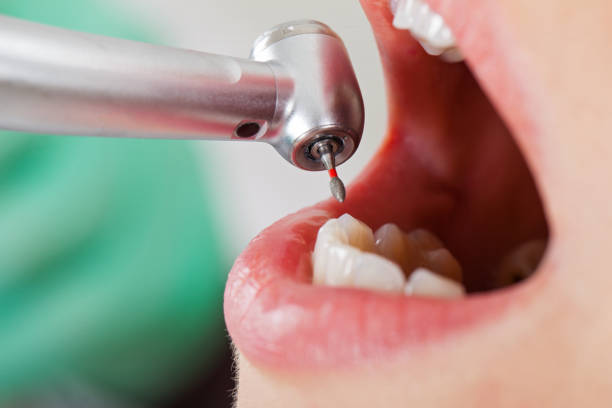 Best Weekend Emergency Dentist in Glasgow Village, MO
